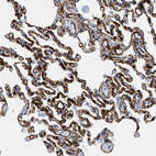 Anti-TVP23B Antibody