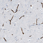 Anti-TVP23B Antibody