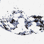 Anti-HEMGN Antibody