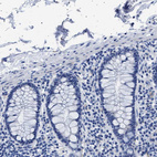 Anti-HEMGN Antibody