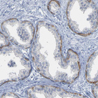 Anti-KRT76 Antibody