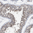 Anti-DDX56 Antibody