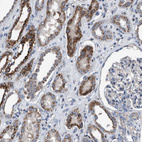 Anti-DDX56 Antibody