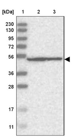 Anti-DDX56 Antibody