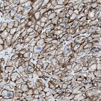 Anti-SLC22A15 Antibody