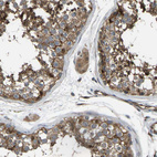 Anti-GAS2L1 Antibody