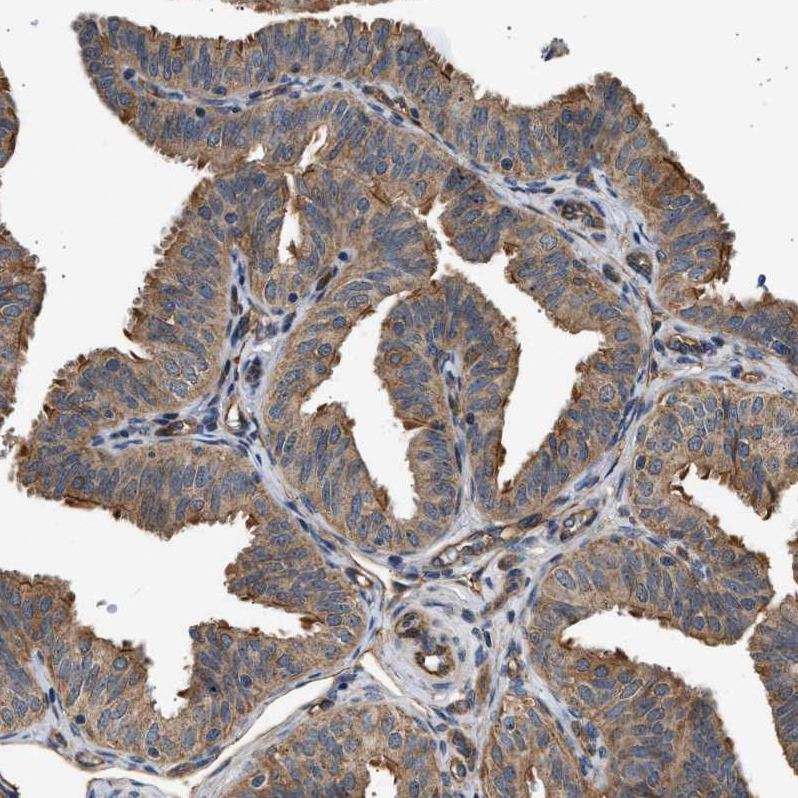 Anti-DUSP14 Antibody