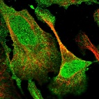 Anti-DUSP14 Antibody