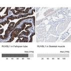 Anti-RUVBL1 Antibody