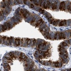 Immunohistochemical staining of human fallopian tube using Anti-RUVBL1 antibody HPA019947.