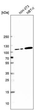 Anti-JADE1 Antibody