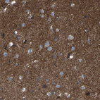 Anti-C7orf49 Antibody