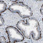 Anti-C7orf49 Antibody