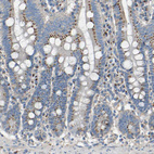 Anti-C7orf49 Antibody