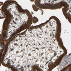 Anti-PTCD1 Antibody