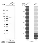 Western blot analysis in human cell lines Caco-2 and A-431 using Anti-PTCD1 antibody. Corresponding PTCD1 RNA-seq data are presented for the same cell lines. Loading control: Anti-PPIB.