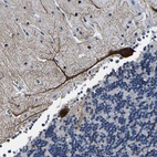 Anti-UBN2 Antibody