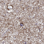 Anti-DDX25 Antibody