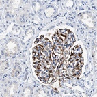 Anti-MED22 Antibody