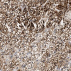 Anti-HDHD3 Antibody