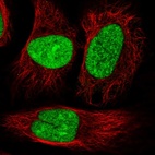 Anti-RBM45 Antibody