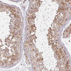 Anti-CNTRL Antibody