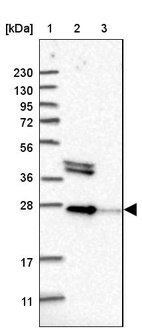 Anti-OSTF1 Antibody