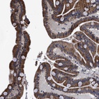 Anti-GOSR1 Antibody