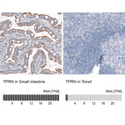 Anti-TPRN Antibody