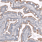 Anti-TPRN Antibody