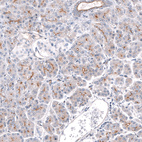 Anti-TPRN Antibody