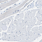 Immunohistochemical staining of human skeletal muscle shows no nuclear positivity in myocytes as expected.