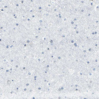 Anti-METTL1 Antibody