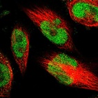 Immunofluorescent staining of human cell line U-251 MG shows localization to nucleoplasm.