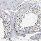 Anti-MURC Antibody