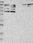 Anti-PARP3 Antibody