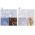 Anti-MYBPC1 Antibody