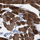 Anti-MYBPC1 Antibody