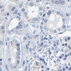 Anti-MYBPC1 Antibody