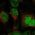 Anti-DUSP11 Antibody