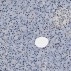 Anti-GTPBP10 Antibody