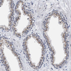 Anti-GOLGA2 Antibody