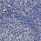 Anti-GOLGA2 Antibody