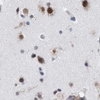 Anti-GOLGA2 Antibody