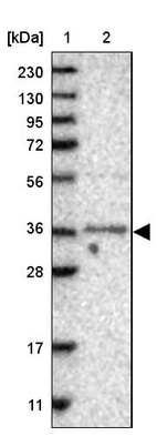 Anti-TRMO Antibody