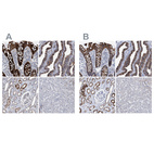 Anti-MKS1 Antibody