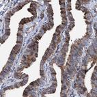 Anti-MKS1 Antibody