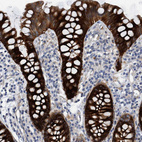 Anti-MKS1 Antibody