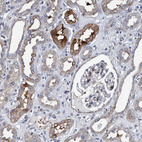 Anti-MKS1 Antibody