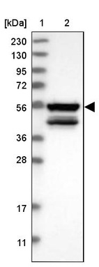 Anti-MKS1 Antibody